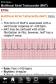 ECG Notes (for ECG interpretation and management) for iPhone
