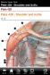 Netter's Upper Limb - Atlas of Human Anatomy (iPhone)